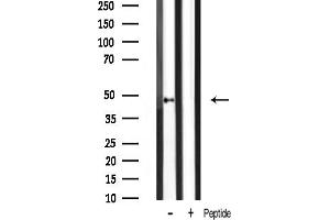 Western blot analysis of G phosphorylation expression in rat spleen tissue lysates,The lane on the right was treated with the antigen-specific peptide.
