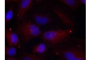 Immunofluorescence staining of methanol-fixed Hela cells using PAK1/PAK2/PAK3(Phospho-Thr423/Thr402/Thr421) Antibody. (PAK1/2/3 antibody  (pThr423))