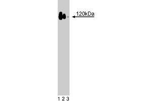 Western blot analysis of p120 Catenin on a A431 cell lysate (Human epithelial carcinoma, ATCC CRL-1555).