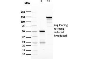 SDS-PAGE Analysis Purified HER-2 Mouse Monoclonal Antibody (ERBB2/3079). (ErbB2/Her2 antibody  (AA 311-462))