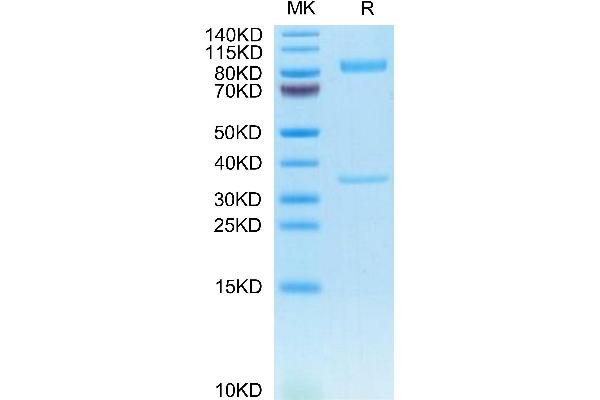 BACE1 Protein (AA 22-457) (Fc Tag)