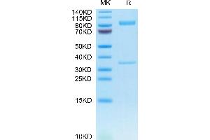 Human BACE-1 on Tris-Bis PAGE under reduced condition. (BACE1 Protein (AA 22-457) (Fc Tag))