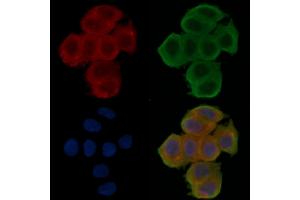 ABIN6257854 and ABIN6276062 staining Hela cells(30 min of UV treatment) by IF/ICC.