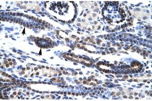 Rabbit Anti-HES7 Antibody Catalog Number: ARP30035 Paraffin Embedded Tissue: Human Kidney Cellular Data: Epithelial cells of renal tubule Antibody Concentration: 4. (HES7 antibody  (Middle Region))