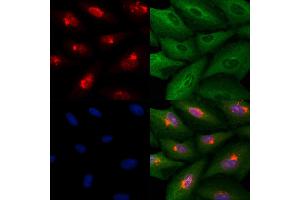 ABIN6259751 and ABIN6278986 staining  cells by IF/ICC.