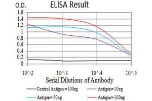 Black line: Control Antigen (100 ng), Purple line: Antigen(10 ng), Blue line: Antigen (50 ng), Red line: Antigen (100 ng), (Cytokeratin 5 antibody  (AA 258-357))