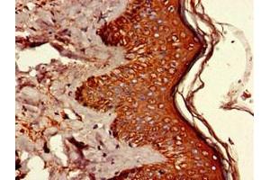 Immunohistochemistry of paraffin-embedded human skin tissue using ABIN7174224 at dilution of 1:100 (Ubiquilin 1 antibody  (AA 1-300))