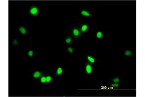 Immunofluorescence of monoclonal antibody to AATF on HeLa cell. (AATF antibody  (AA 151-250))