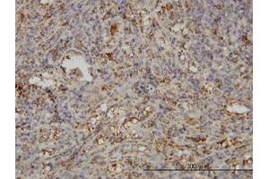Image no. 1 for anti-Synaptosomal-Associated Protein, 23kDa (SNAP23) (AA 1-212) antibody (ABIN599065) (SNAP23 antibody  (AA 1-212))