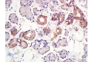 Formalin-fixed and paraffin embedded human larynx labeled with Rabbit Anti-MFSD2A Polyclonal Antibody, Unconjugated  at 1:200 followed by conjugation to the secondary antibody and DAB staining (MFSD2A antibody  (AA 331-430))