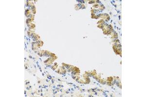 Immunohistochemistry of paraffin-embedded mouse lung using CDKN2C antibody (ABIN5971074) at dilution of 1/100 (40x lens). (CDKN2C antibody)