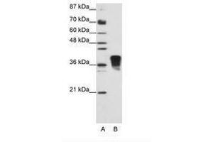 Image no. 2 for anti-Transformer 2 beta Homolog (TRA2B) (N-Term) antibody (ABIN202162) (TRA2B antibody  (N-Term))