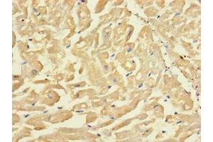 Immunohistochemistry of paraffin-embedded human heart tissue using ABIN7170255 at dilution of 1:100 (SLC43A3 antibody  (AA 209-278))