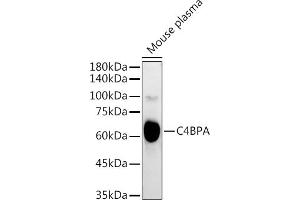 Western blot analysis of extracts of Mouse plasma, using C4BPA antibody (ABIN6134574, ABIN6137773, ABIN6137774 and ABIN6223565) at 1:3000 dilution. (C4BPA antibody  (C-Term))
