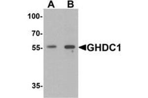 Western blot analysis of GHDC in 293 cell lysate with GHDC antibody at  (A) 0.