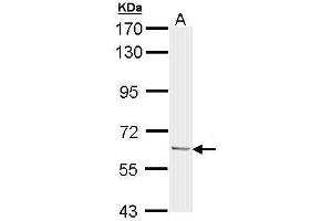 WB Image Sample (30 ug of whole cell lysate) A: 293T 7. (Ubiquilin 1 antibody)