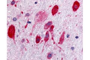 Anti-GPR171 antibody IHC of rat brain, neurons. (GPR171 antibody  (Cytoplasmic Domain))
