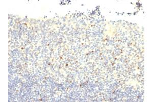 Formalin-fixed, paraffin-embedded human Tonsil stained with FOXP3 Monoclonal Antibody (FXP3/197). (FOXP3 antibody)