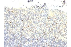 Formalin-fixed, paraffin-embedded human Tonsil stained with FOXP3 Monoclonal Antibody (FXP3/197). (FOXP3 antibody)
