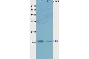 L1 human colon carcinoma lysates L2 rat brain lysates probed with Anti RhoA Polyclonal Antibody, Unconjugated (ABIN738846) at 1:200 overnight at 4 °C. (RhoA, C (AA 101-193) antibody)