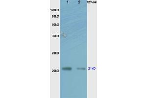 L1 human colon carcinoma lysates L2 rat brain lysates probed with Anti RhoA Polyclonal Antibody, Unconjugated (ABIN738846) at 1:200 overnight at 4 °C.