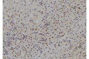 ABIN6273704 at 1/100 staining Human liver tissue by IHC-P. (MCM9 antibody  (C-Term))