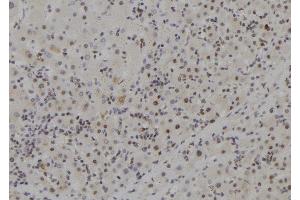 ABIN6273704 at 1/100 staining Human liver tissue by IHC-P. (MCM9 antibody  (C-Term))