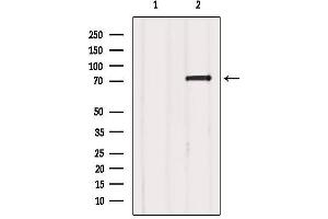 Western blot analysis of extracts from Mouse brain, using FXR1 Antibody.