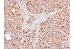 IHC-P Image Immunohistochemical analysis of paraffin-embedded SW480 xenograft, using TRAF1, antibody at 1:100 dilution. (TRAF1 antibody)