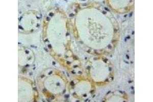 #VALUE! (Nephrin antibody  (AA 39-144))