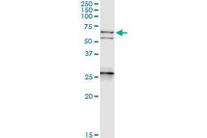 Immunoprecipitation of NEFL transfected lysate using anti-NEFL MaxPab rabbit polyclonal antibody and Protein A Magnetic Bead , and immunoblotted with NEFL purified MaxPab mouse polyclonal antibody (B01P) . (NEFL antibody  (AA 1-543))