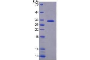 Image no. 1 for Complement Factor I (CFI) (AA 358-603) protein (His tag) (ABIN4988954)
