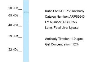 Western Blotting (WB) image for anti-Centrosomal Protein 68kDa (CEP68) (N-Term) antibody (ABIN2789197) (CEP68 antibody  (N-Term))