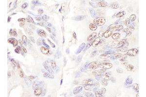 Immunohistochemistry (IHC) image for anti-Cyclin-Dependent Kinase-Like 5 (CDKL5) (AA 350-400) antibody (ABIN7453908) (CDKL5 antibody  (AA 350-400))