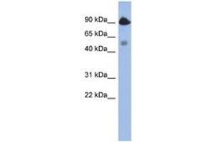 Image no. 1 for anti-BCL2-Like 13 (Apoptosis Facilitator) (BCL2L13) (AA 395-444) antibody (ABIN6744342) (BCL2L13 antibody  (AA 395-444))