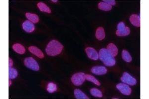 Immunofluorescence (IF) image for anti-Histone Cluster 1, H3a (HIST1H3A) (H3K27me3) antibody (ABIN7139677)