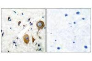 Immunohistochemical analysis of paraffin-embedded human brain tissue using GluR8 antibody. (GRM8 antibody)