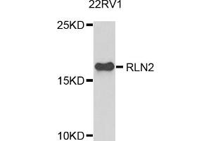 Western blot analysis of extracts of 22Rv1 cells, using RLN2 antibody. (Relaxin 2 antibody)