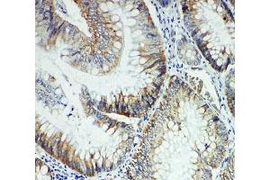 IHC-P: FER antibody testing of rat intestine tissue