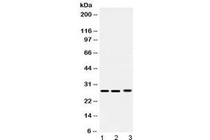 Western blot testing of 1) rat testis, 2) mouse lung and 3) human 293T lysate with PSMA3 antibody at 0. (PSMA3 antibody  (AA 88-127))