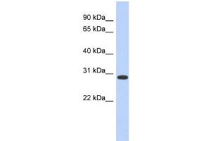 WB Suggested Anti-HOXD12 Antibody Titration:  0. (HOXD12 antibody  (Middle Region))