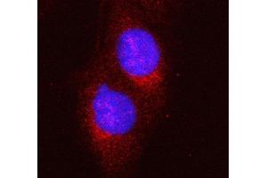 IF analysis of HERC5 using anti-HERC5 antibody (ABIN6719405). (HERC5 antibody  (AA 793-1024))