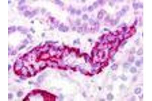 Anti-GPRC5D antibody IHC of human kidney, renal tubule.