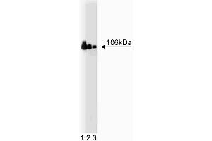 Western blot analysis of Adaptin beta on a Jurkat cell lysate (Human T-cell leukemia, ATCC TIB-152) (left).