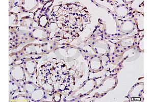 Formalin-fixed and paraffin embedded: rat kidney tissue labeled with Anti-ILK-1 Polyclonal Antibody (ABIN727800), Unconjugated at 1:200, followed by conjugation to the secondary antibody and DAB staining (ILK antibody  (AA 301-400))