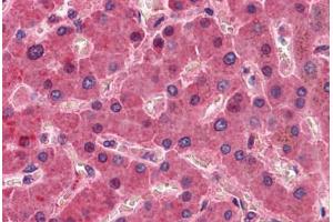 Liver, Human: Formalin-Fixed, Paraffin-Embedded (FFPE) (F12 antibody)