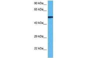 Host:  Rabbit  Target Name:  SNRNP70  Sample Tissue:  Human DLD1 Whole Cell  Antibody Dilution:  1ug/ml (SNRNP70 antibody  (C-Term))