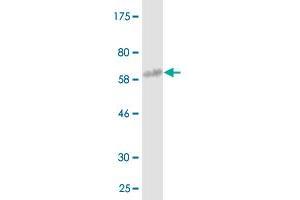 Western Blot detection against Immunogen (61. (Annexin A3 antibody  (AA 1-323))