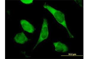 Immunofluorescence of purified MaxPab antibody to TIMM8A on HeLa cell. (TIMM8A/DDP antibody  (AA 1-97))