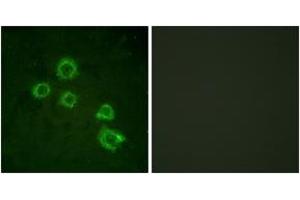 Immunofluorescence analysis of HuvEc cells, using c-PLA2 (Ab-505) Antibody. (C-PLA2 (AA 471-520) antibody)